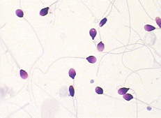 Morfología de la esperma BRED-015 que mancha el método de Kit Diff Quik Rapid Staining