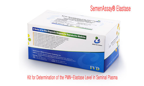 40T/Kit Kit de fragmentación del ADN del esperma con método SCD y CE aprobado para pruebas precisas de fragmentación del ADN