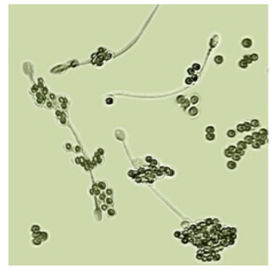 Equipo masculino de la prueba de la fertilidad BRED-011 para la diagnosis masculina de la infertilidad de los espermatozoides de la determinación
