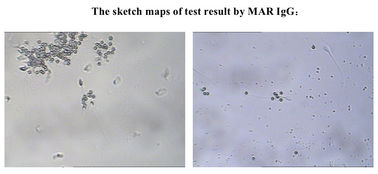 Equipo masculino de la prueba de la fertilidad de SpermFunc para los espermatozoides de la capa del anticuerpo de IgG de la determinación