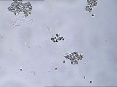 Equipo de la prueba de función de la esperma de MARCHA IgA Test Kit IgA Antibody Coating Spermatozoa MARCHA