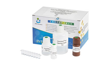 Nivel masculino de Kit For Determination Acid Phosphatase de la prueba de la fertilidad BRED-009 en plasma seminal