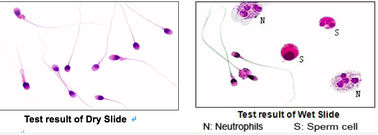 La prueba de la morfología del glóbulo pre manchó diapositivas