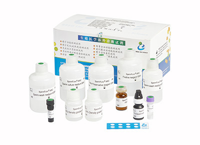Equipo inducido de Kit Accuracy Male Fertility Test el reactivo de la reacción del Acrosome de la esperma
